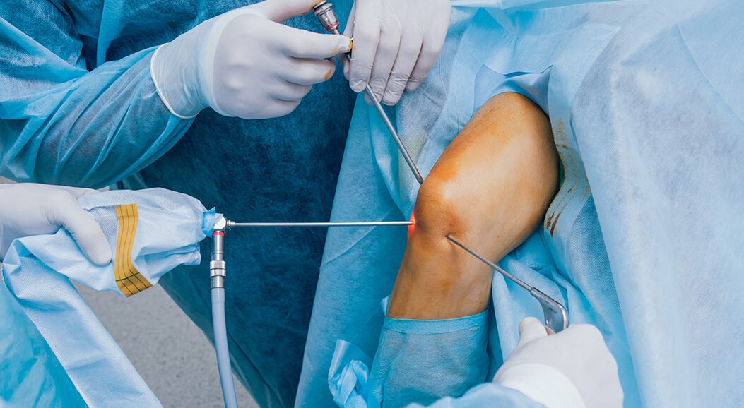 Arthroscopic Surgery | Best Multispeciality Hospital in Hyderabad